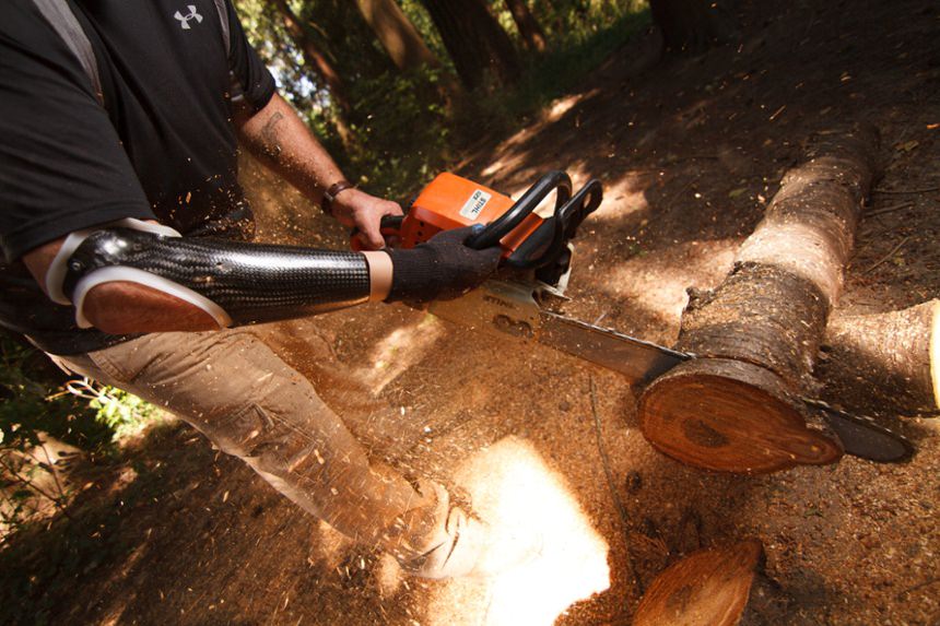 Arm Dynamics patient working in the logging industry.