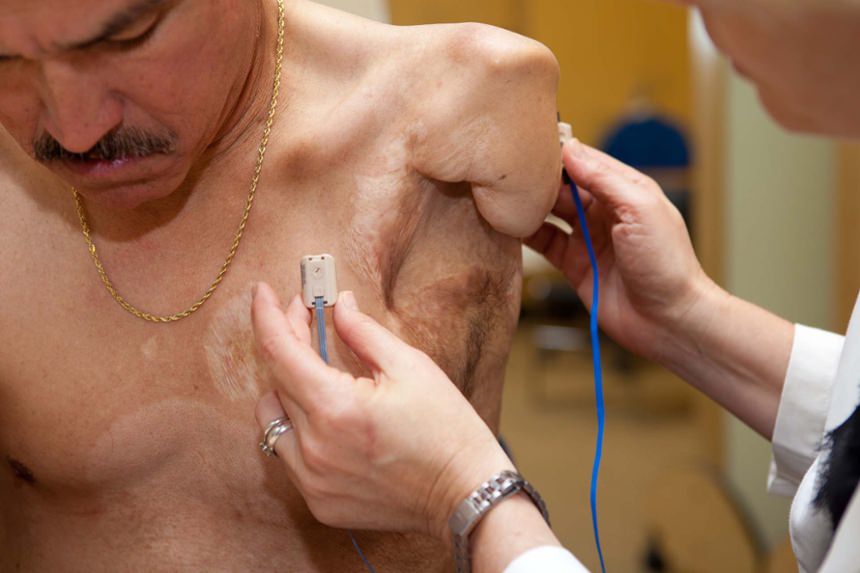 Biofeedback Therapy