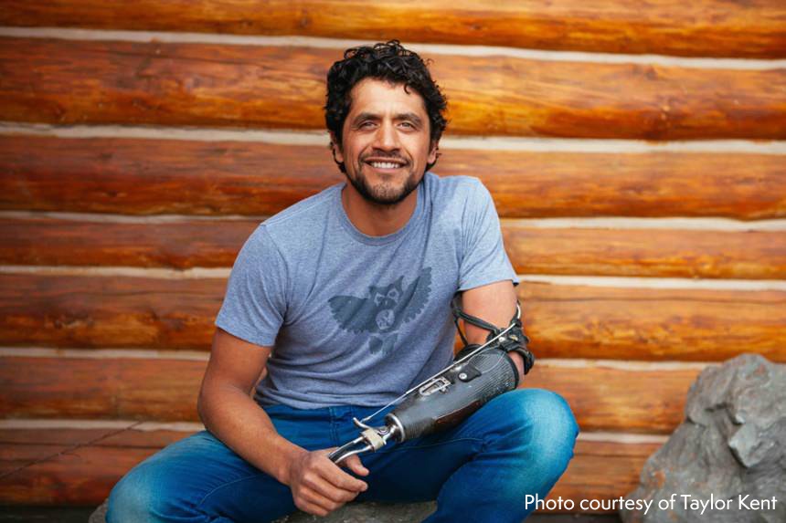 Arm Dynamics patient Eduardo Garcia wearing his body powered prosthesis