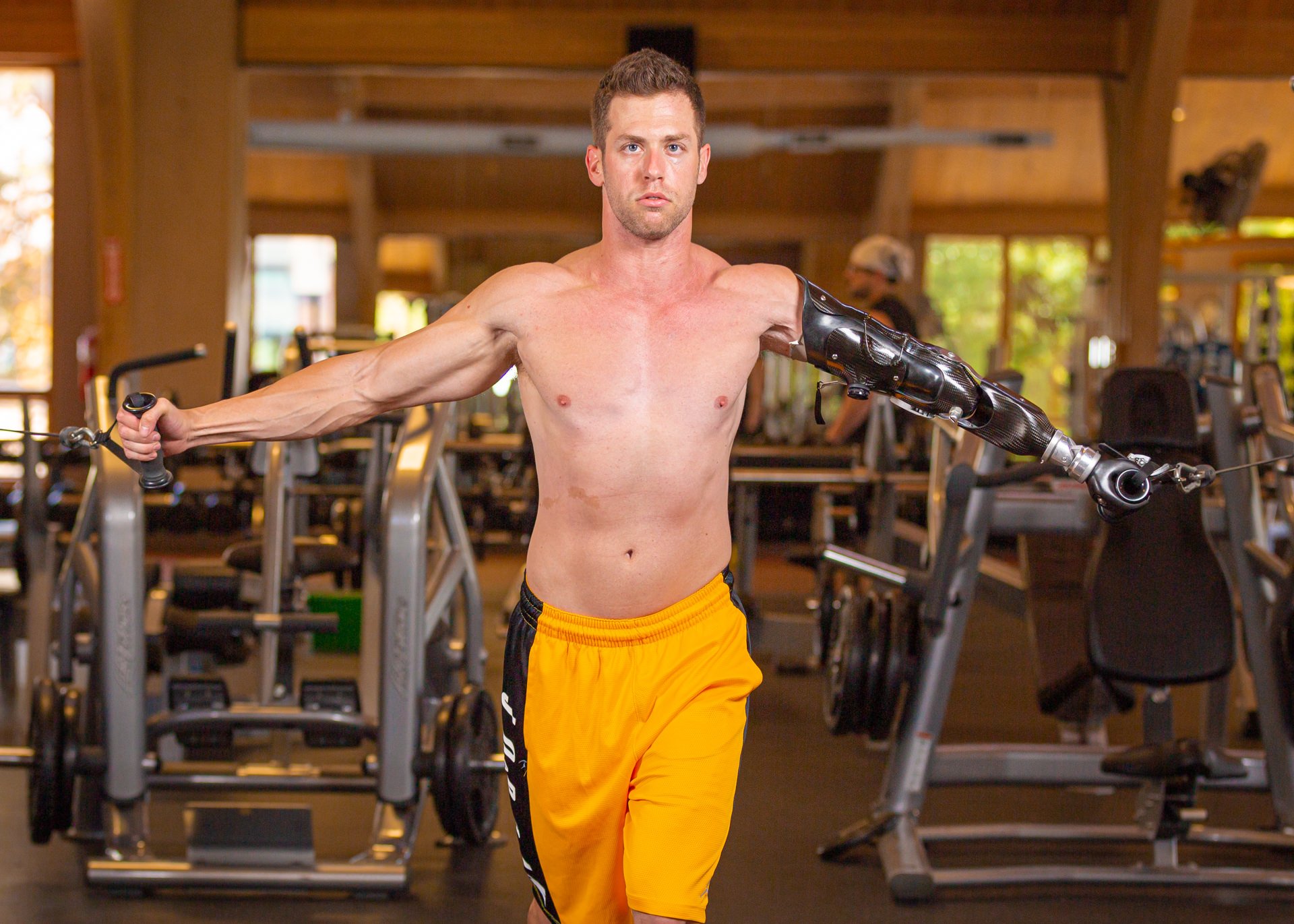 Congenital above-the-elbow limb difference patient, Max Okun uses his activity-specific prosthesis to meet his demanding workouts at the gym every day.