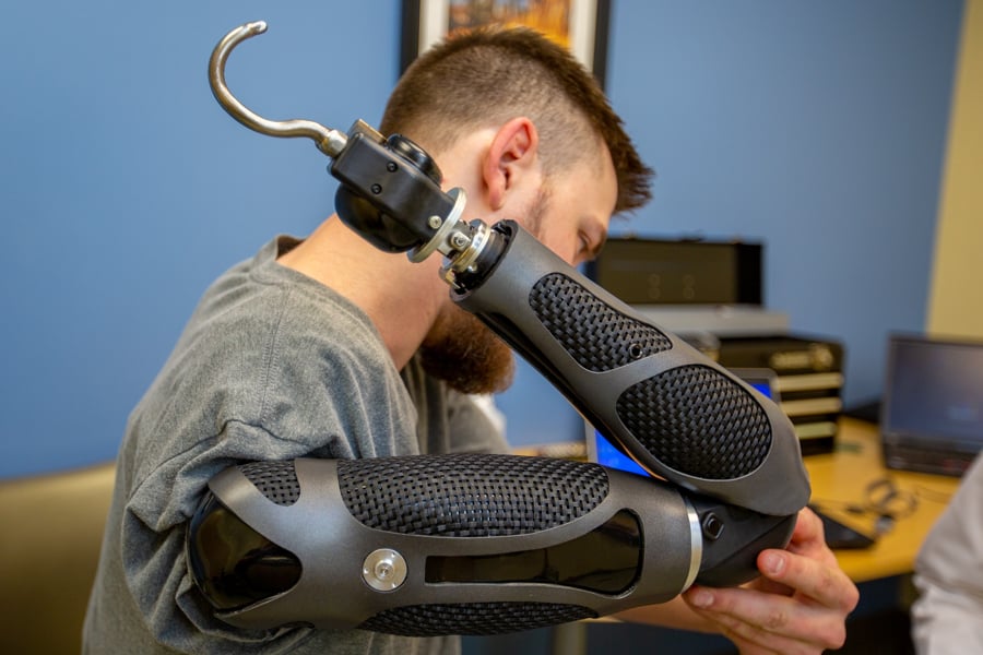 Introduction to Myoelectric Prostheses