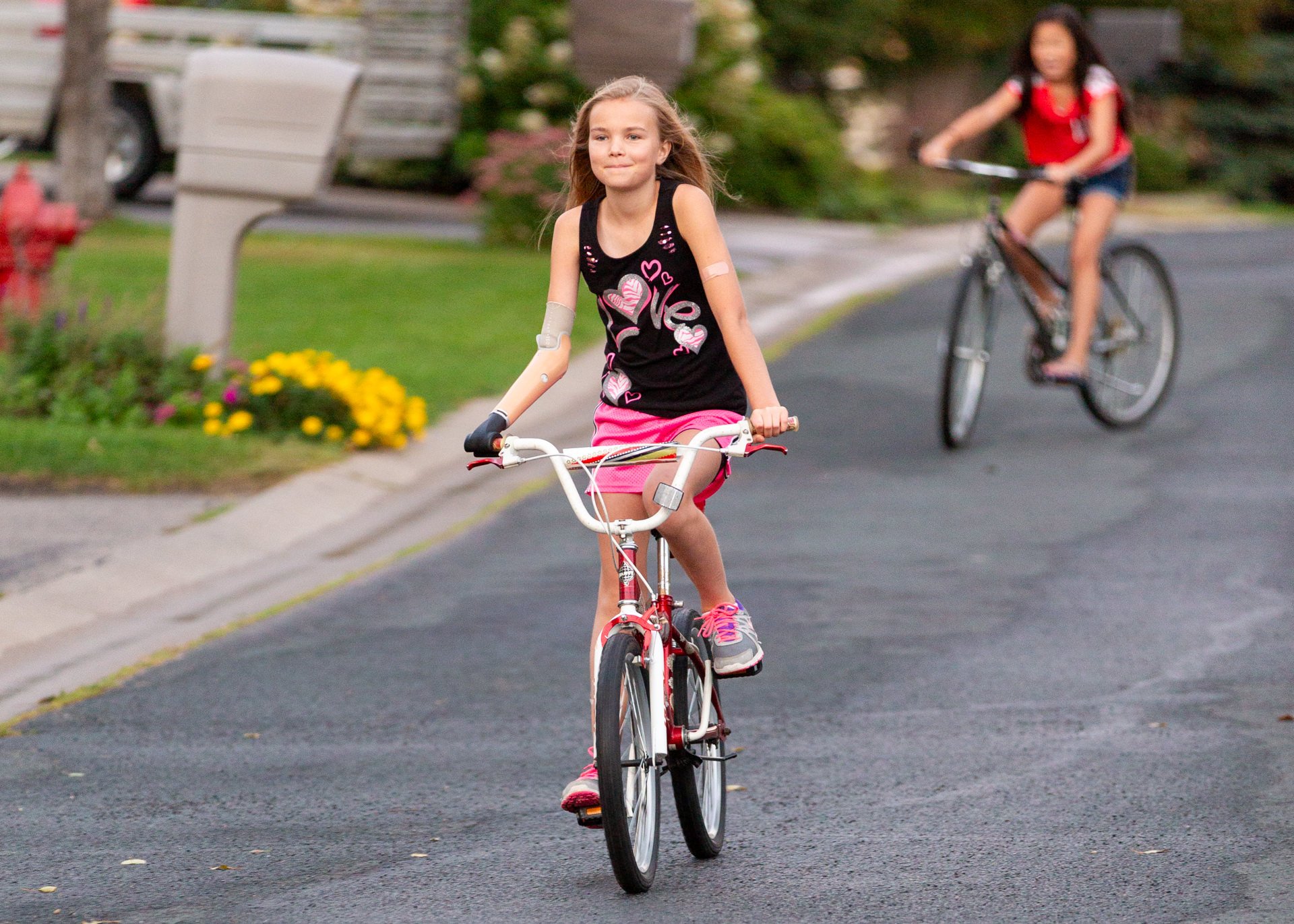 Congenital pediatric patient Amber Peterson uses her activity-specific prosthesis to ride bikes with friends.