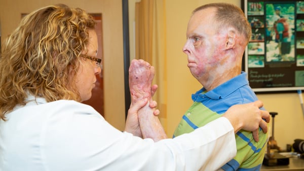 A Clinical Therapy Specialist works on strengthening a patients limb who was thermally injured