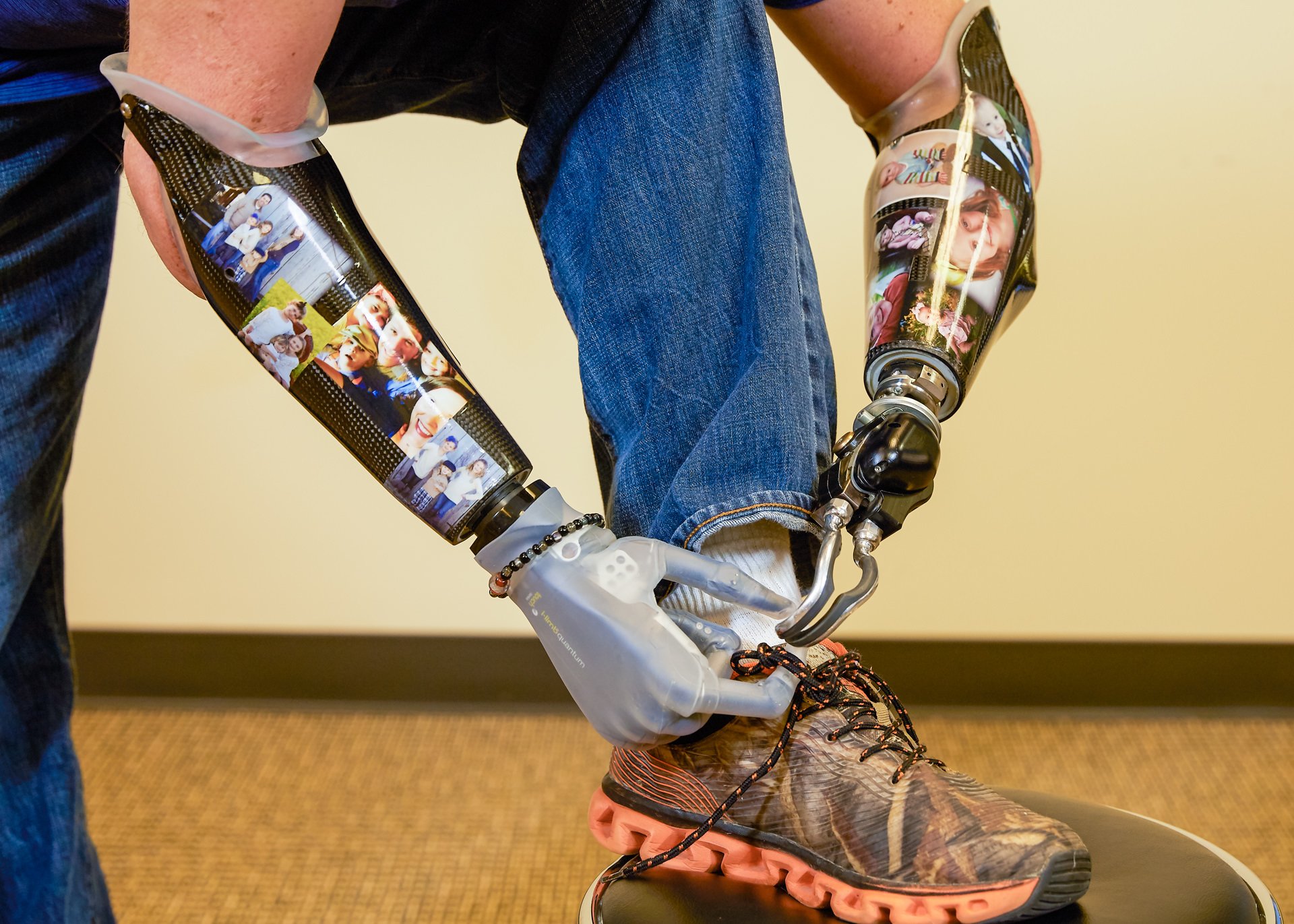 Jason Koger, a bilateral transradial patient, uses an ETD and his i-limb prosthesis to tie his shoes.