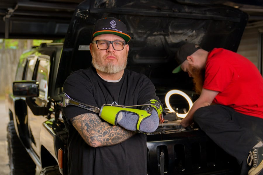 Amputee works on a car in his garage