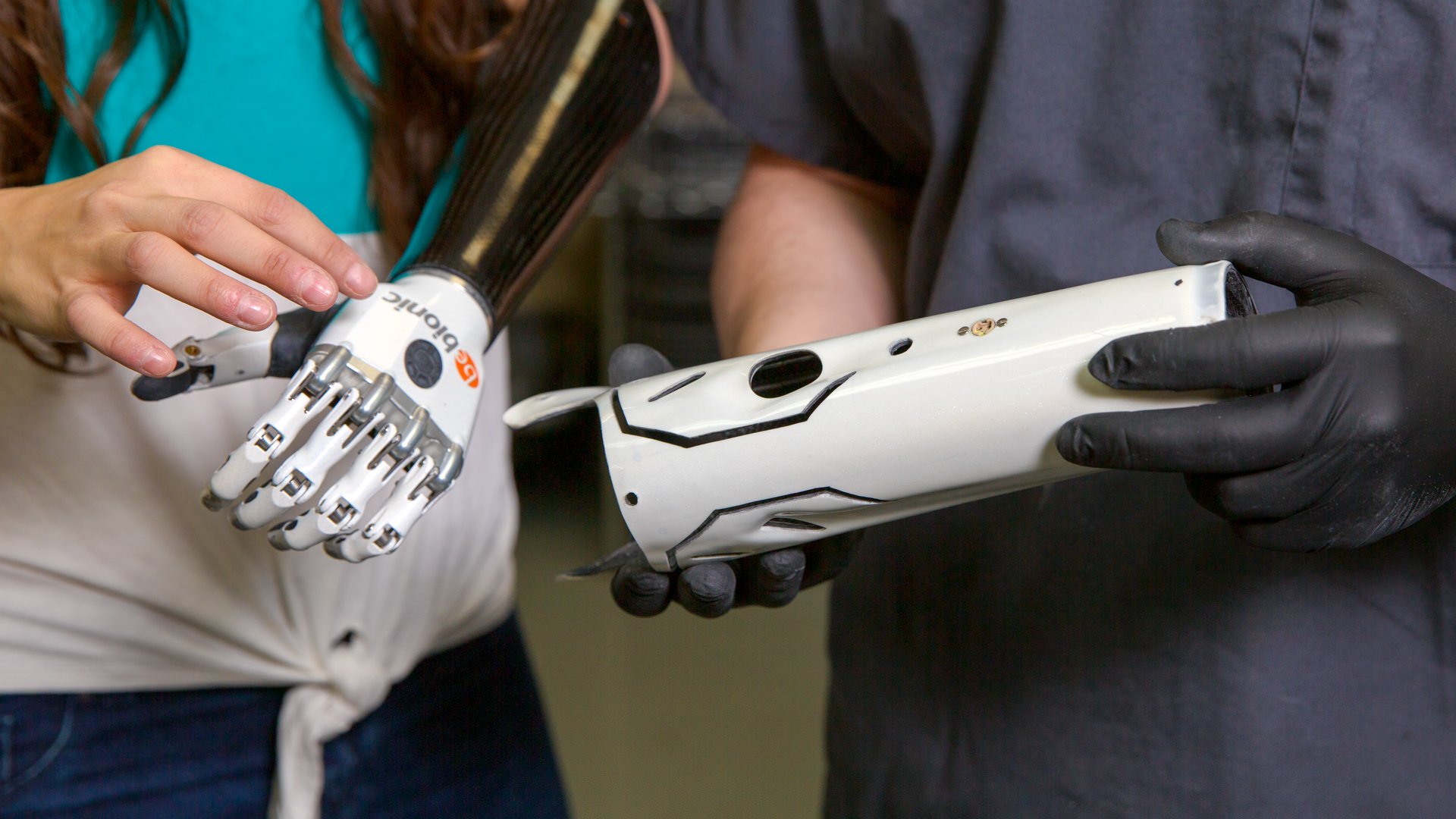 Angels bebionic hand with custom fabricated frame