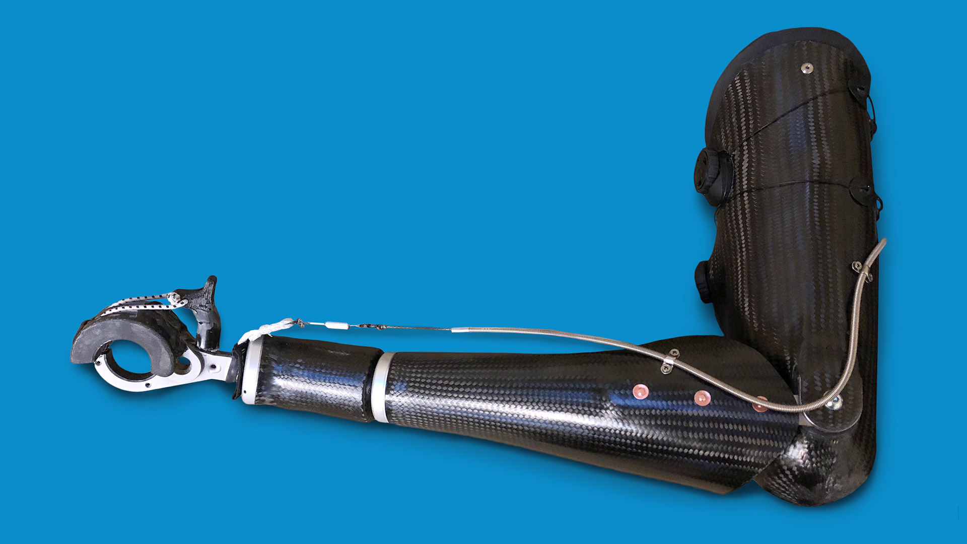 Austin Andersons Chainsaw prosthesis