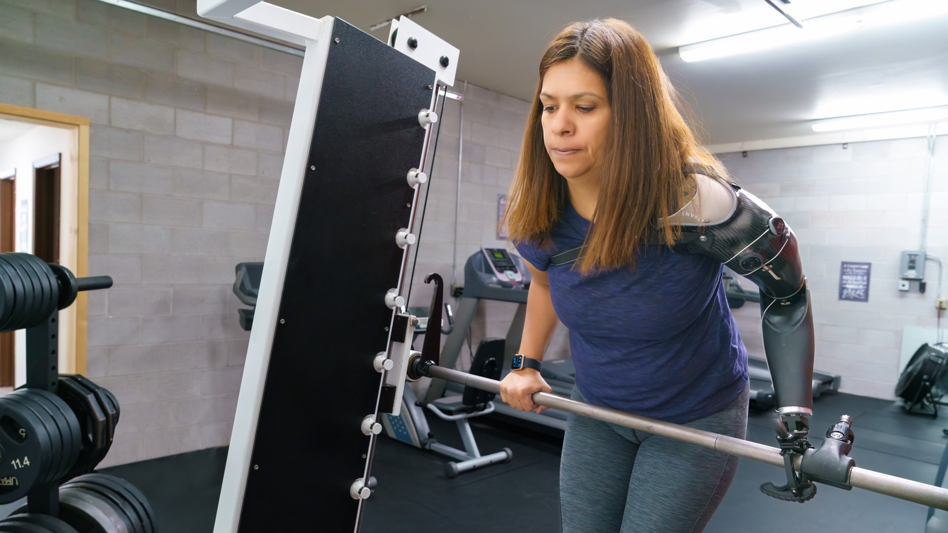 Claudia getting her workout done at the Gym with the assistance of her hybrid prosthesis