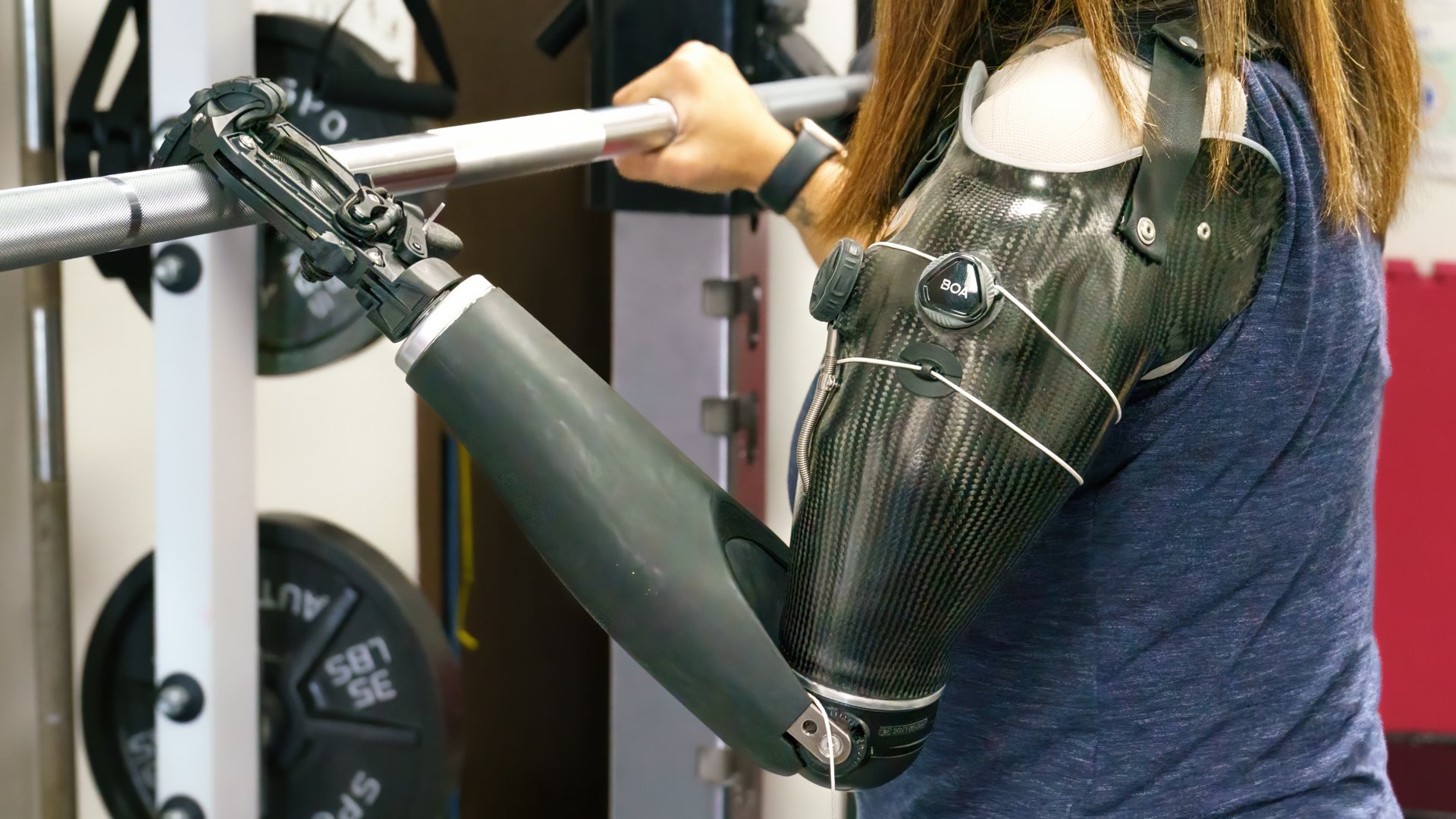 Claudias workout prosthesis
