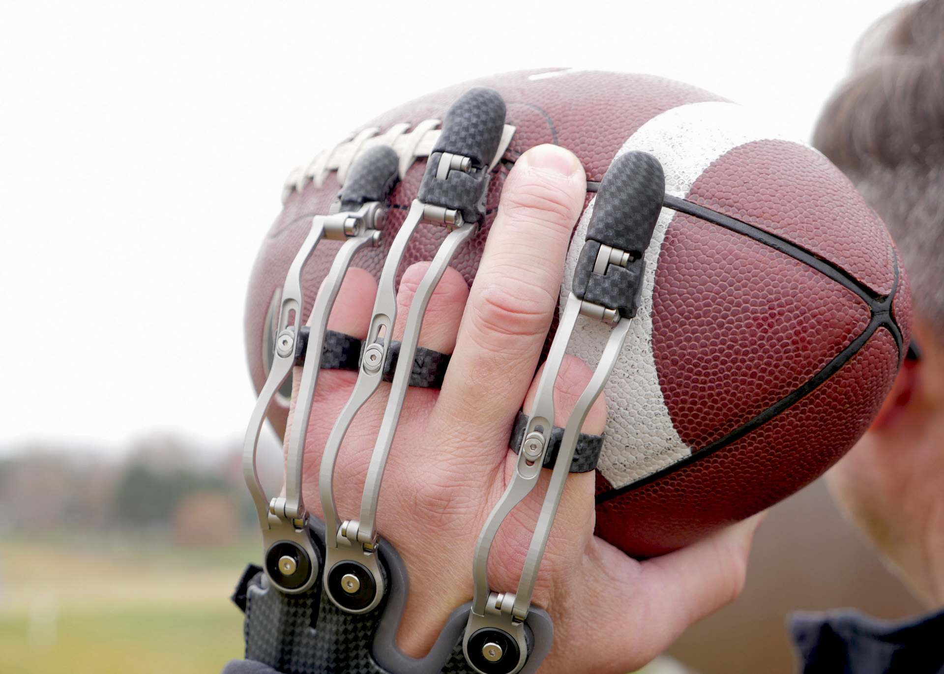 A partial hand patient wears Naked Prosthetics MCP drivers to throw a football.