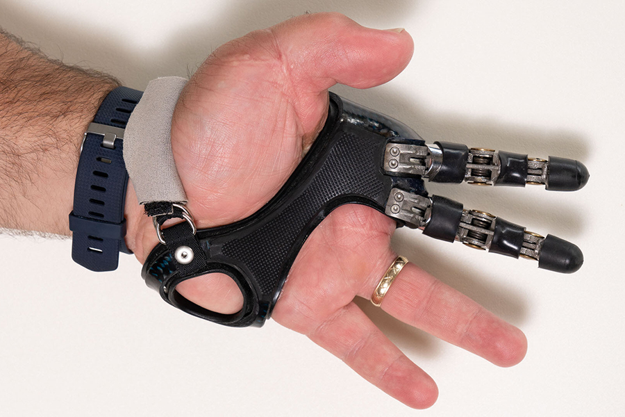Point Designs prosthetic components Arm Dynamics