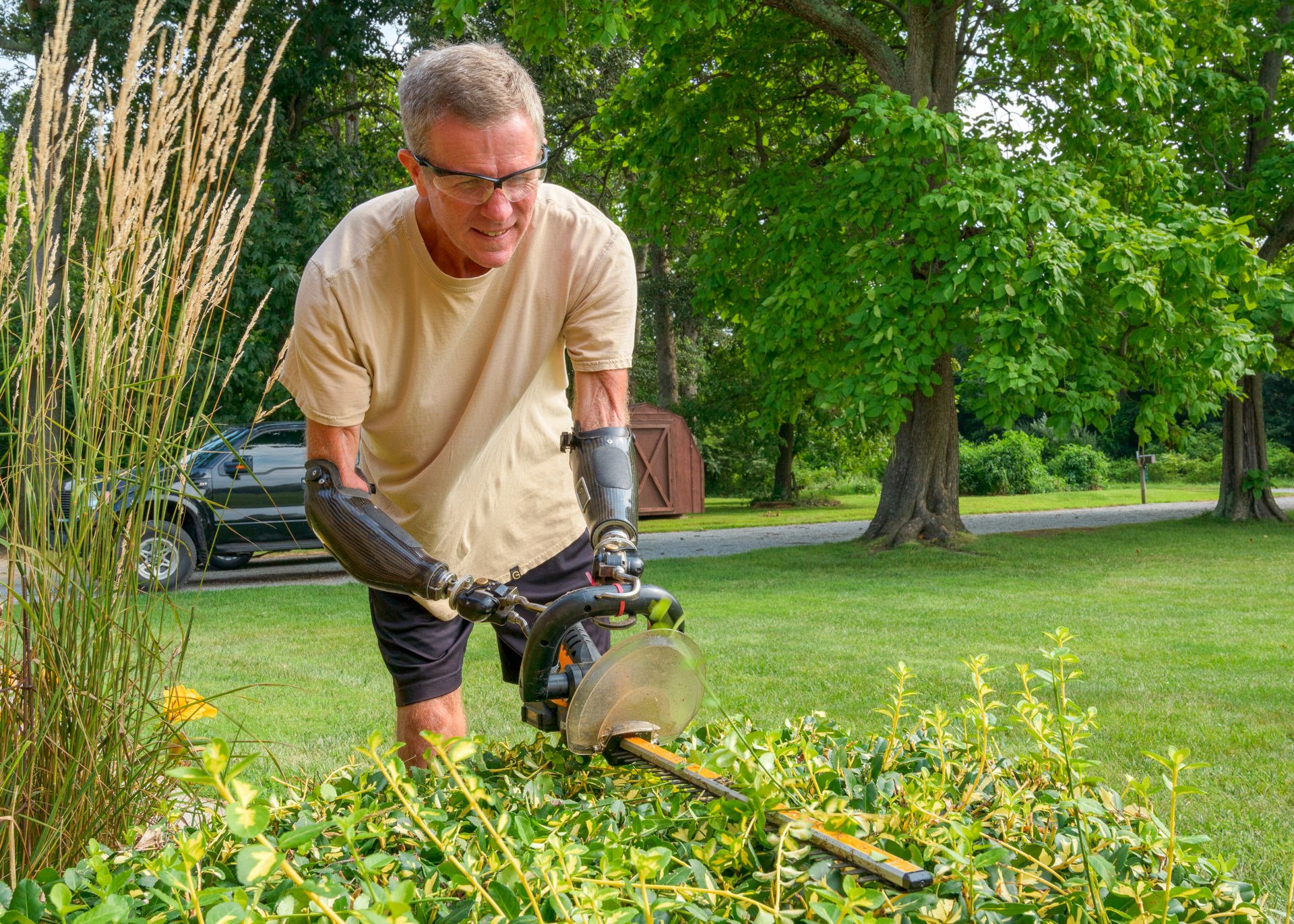 A bilateral transradial patient, Gerry Kinney uses his electrically-powered ETDs when working in the yard.
