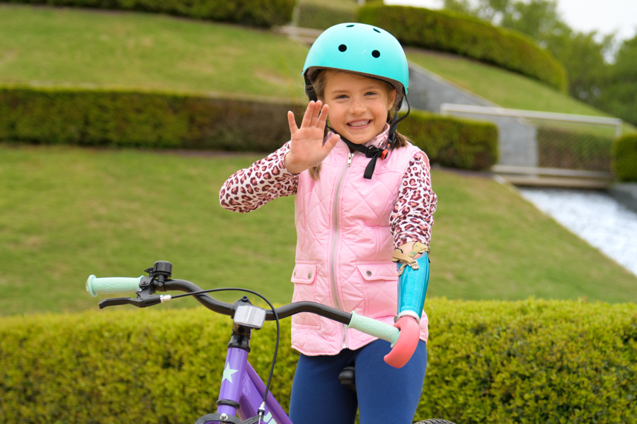 Pediatric Child with Congenital Limb Difference on a Bike