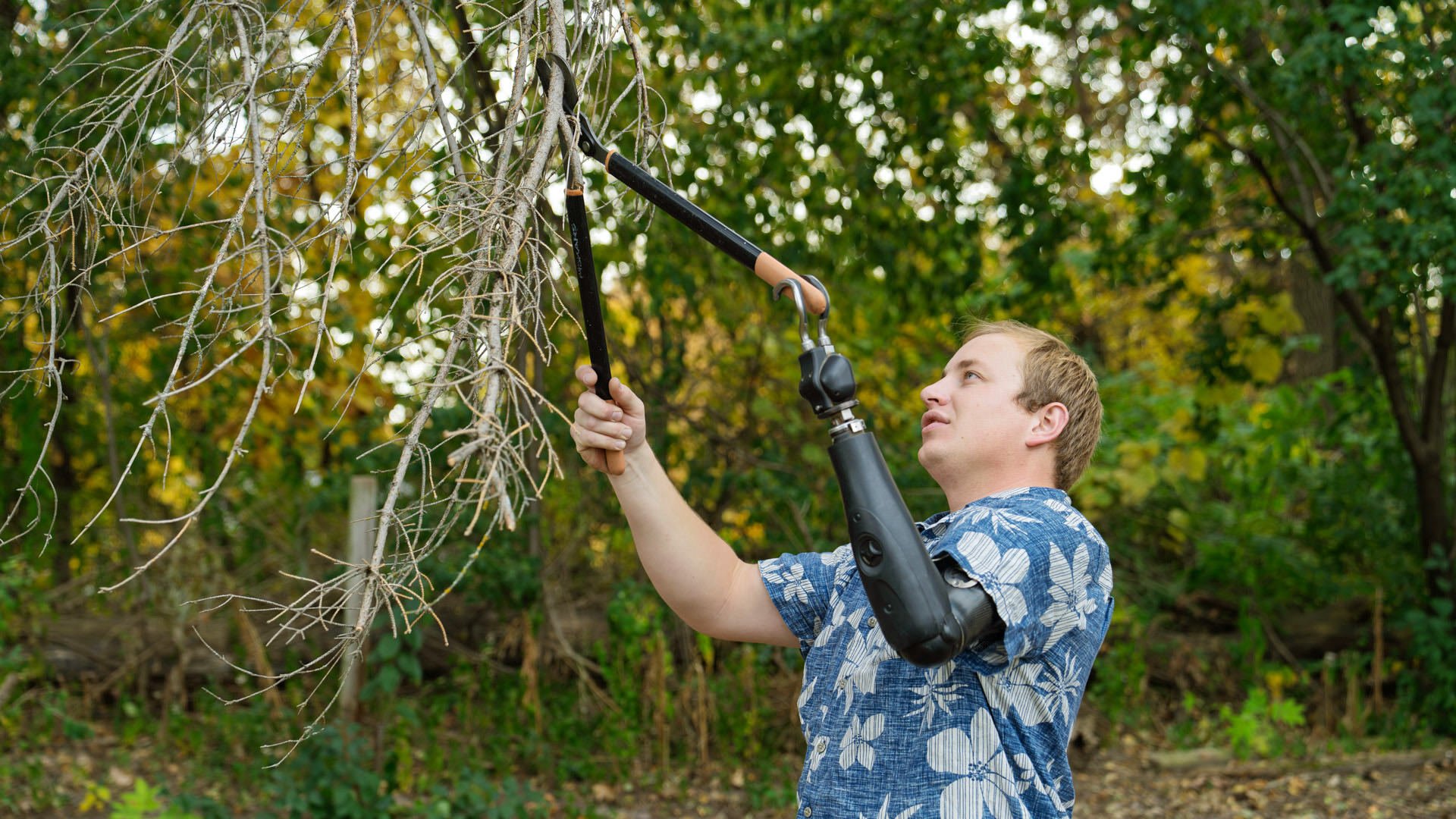 Transhumeral Amputee Doing Yard Work With ETD Prosthesis