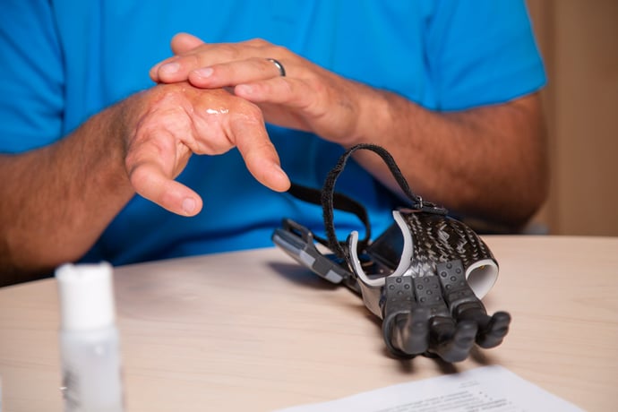 Donning a partial hand prosthesis