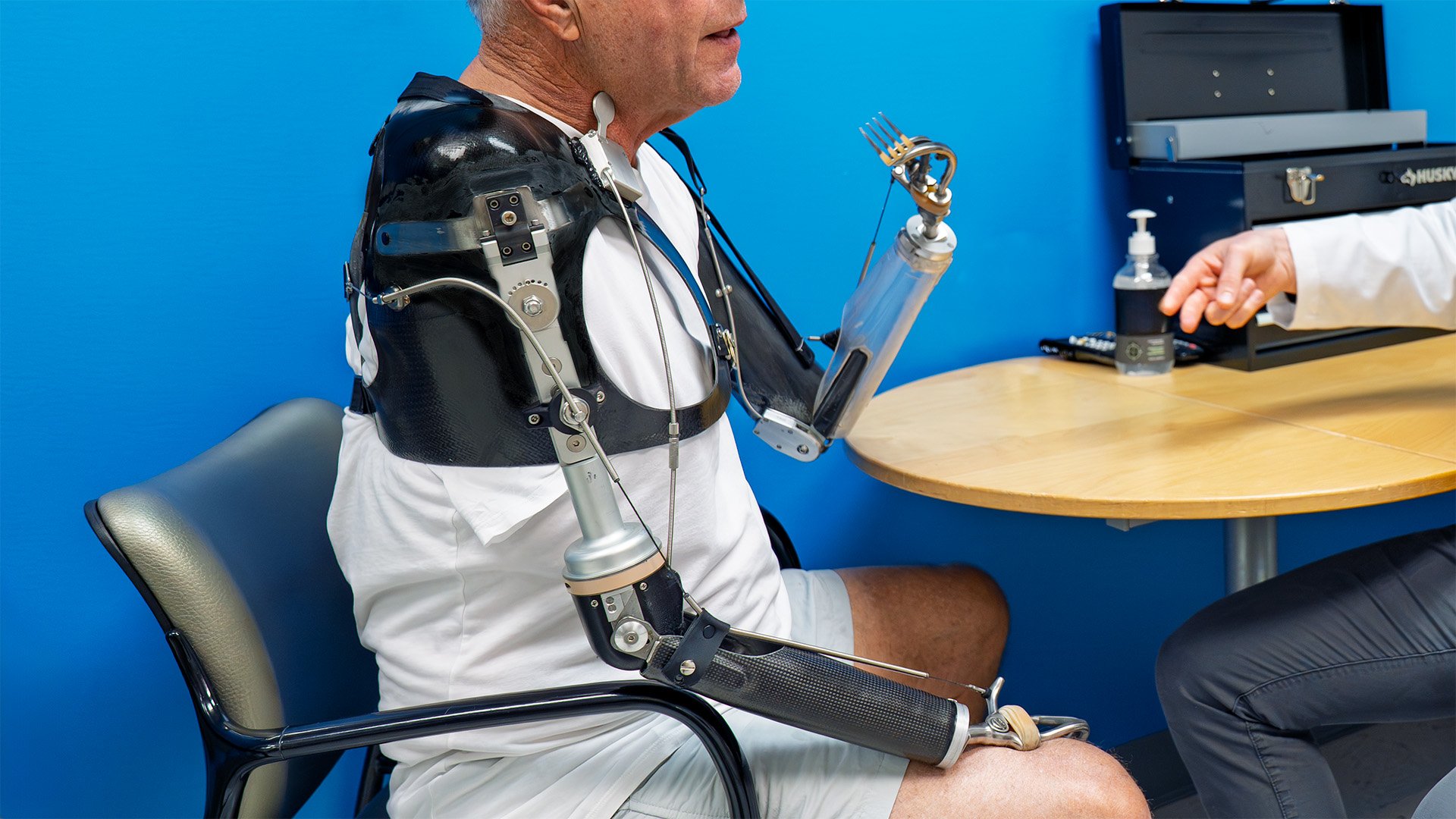 Doug's Bilateral Prosthesis