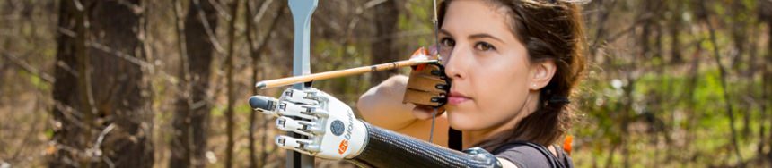 Angel Giuffria Congenital Below the Elbow Bebionic Hand Model Actree
