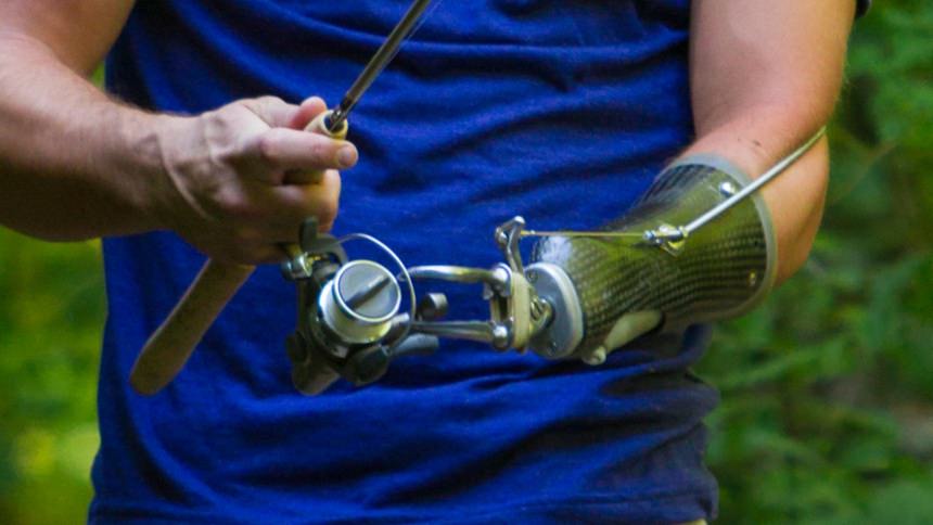 Custom Carbon Fiber Socket with body-powered hook
