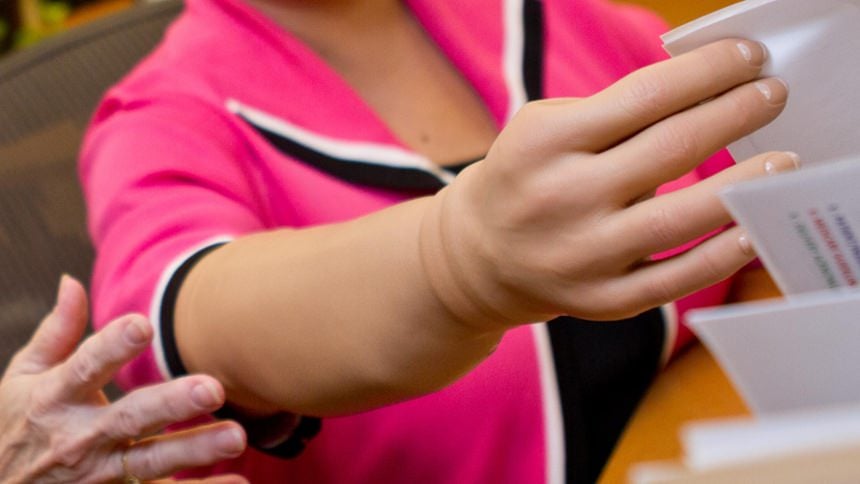 A myoelectric prosthesis with SensorHand Speed and passive wrist rotation is helpful at work.