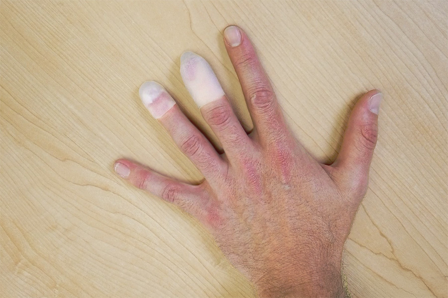 Fingertip-Listing (1)