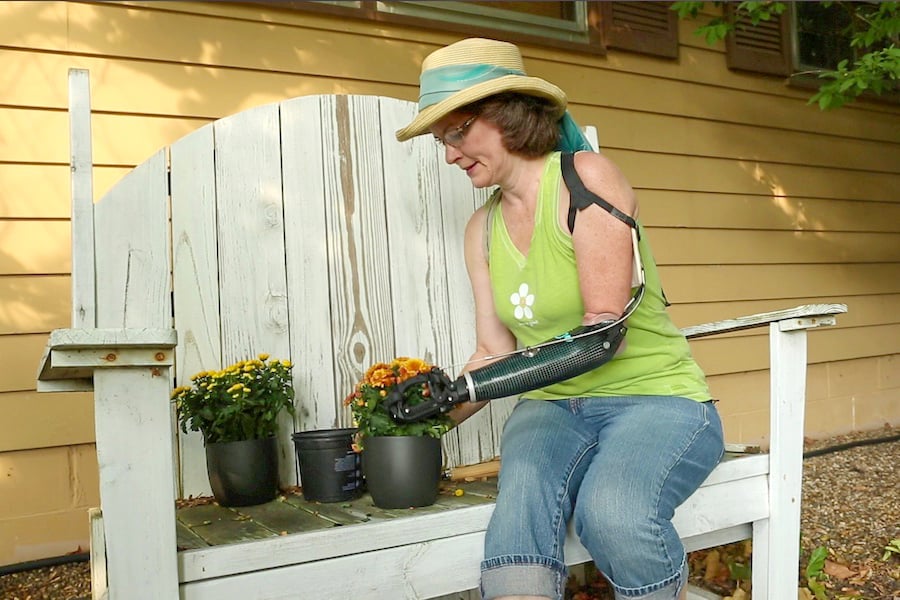 Gardening with a Prosthesis