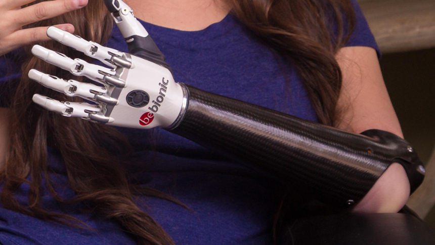 Custom Carbon Fiber Frame with bebionic hand