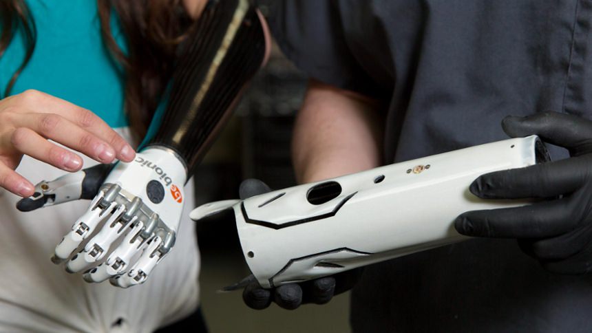 Custom Carbon Socket with bebionic hand