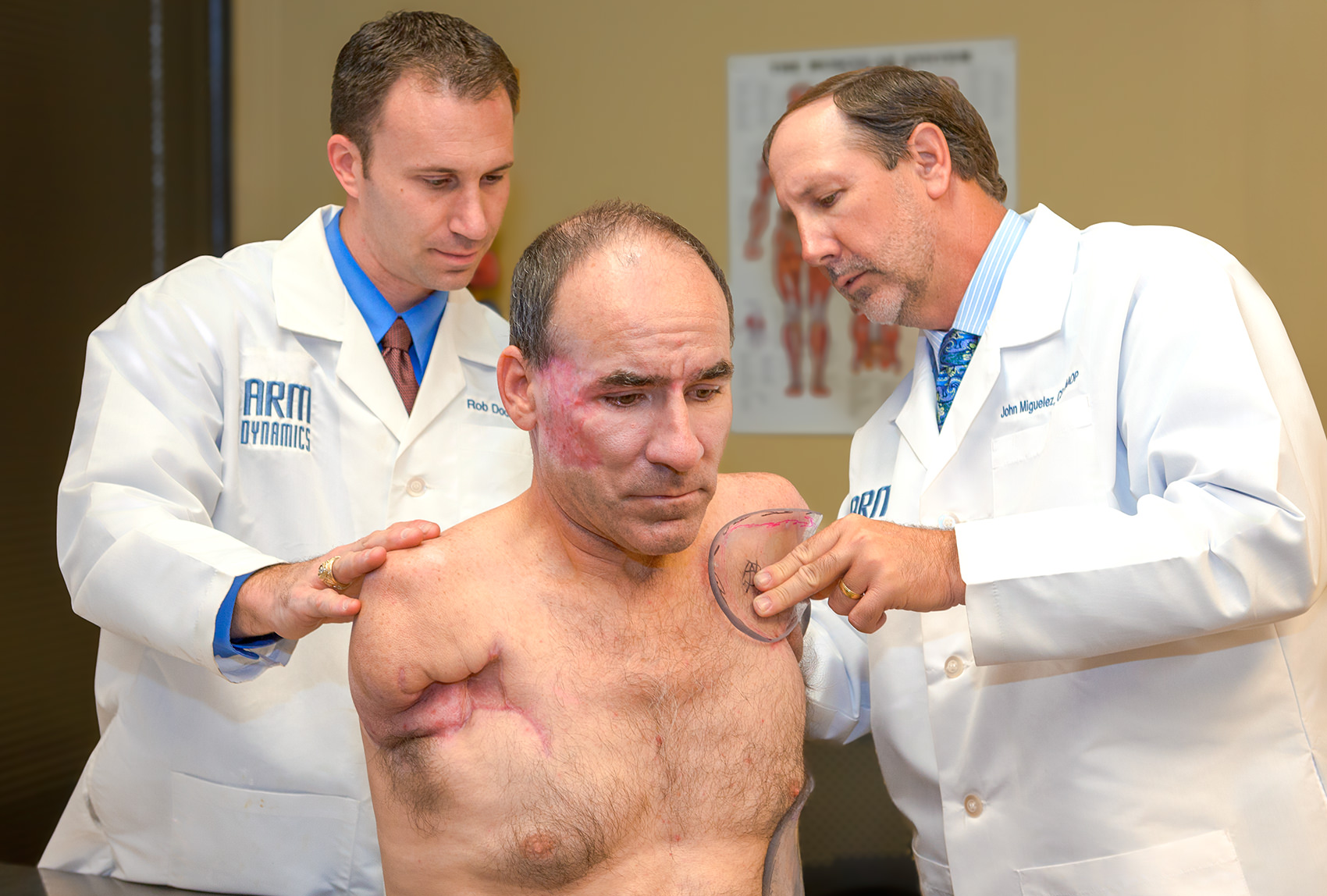 Bilateral Shoulder Disarticulation patient being fit at the Southwest Center