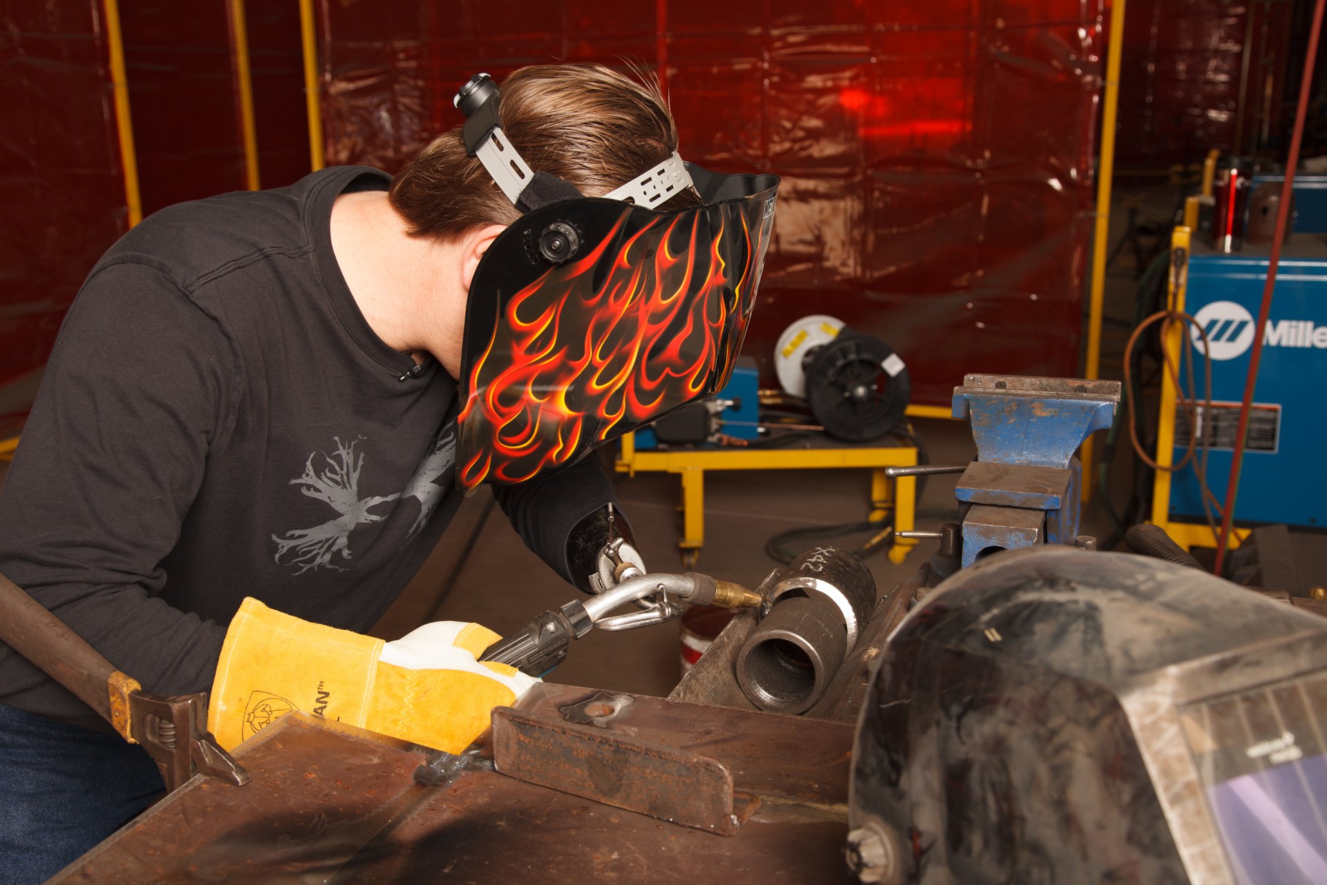 Prosthetic Technology Arm Dynamics