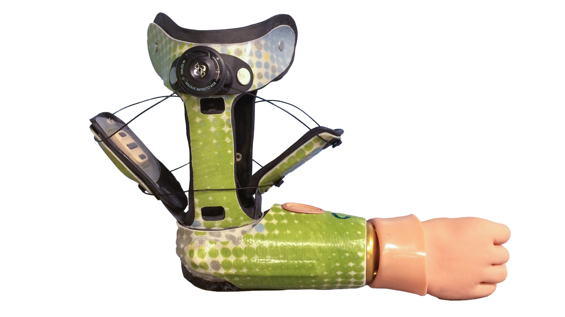 Jameson Prosthesis Overview