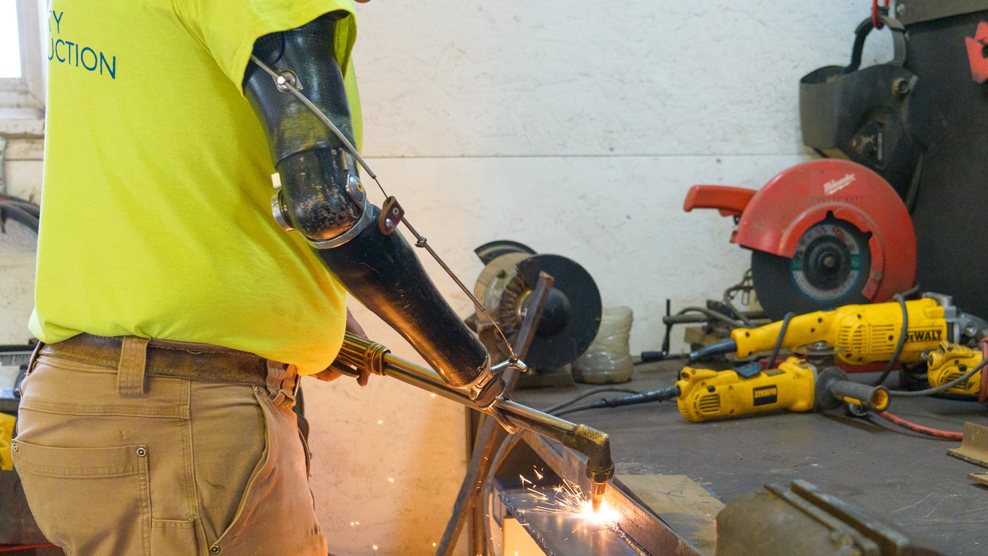 John Mitchell Prosthesis with Cutting Torch