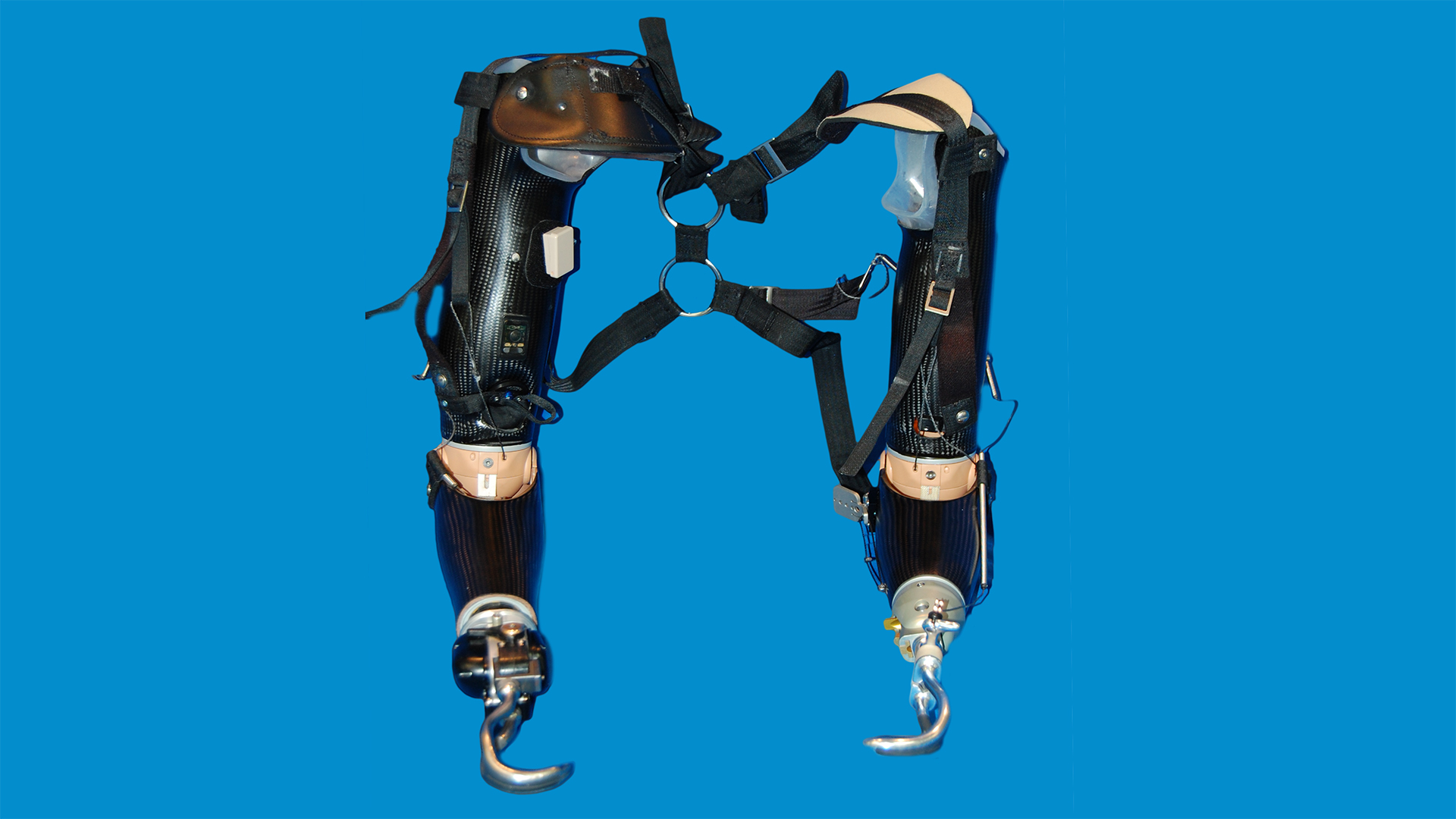 Justin Goodin's Hybrid Prosthesis has an ETD (Electronic Terminal Device) on the left side, and a body-powered hook on the right side.