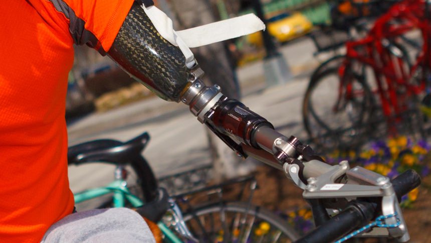 Mike uses an activity-specific prosthesis to ride his bike as he trains for athletic competitions.