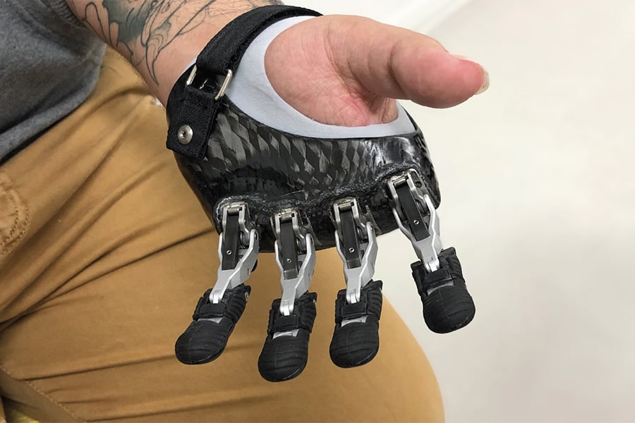 Naked Prosthetic Grip Lock Fingers