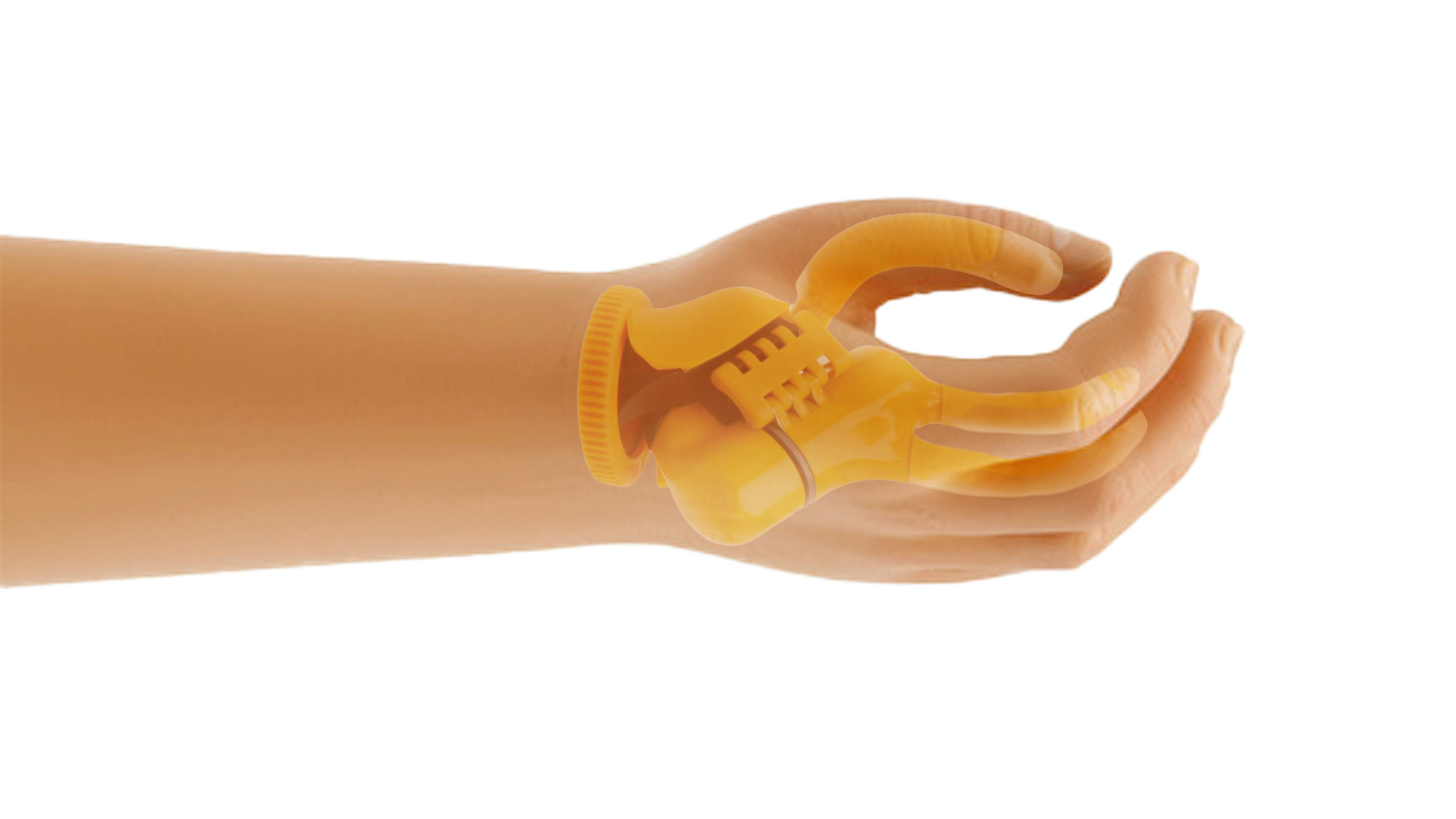 Ottobock Electrohand 2000 (Superimposed)