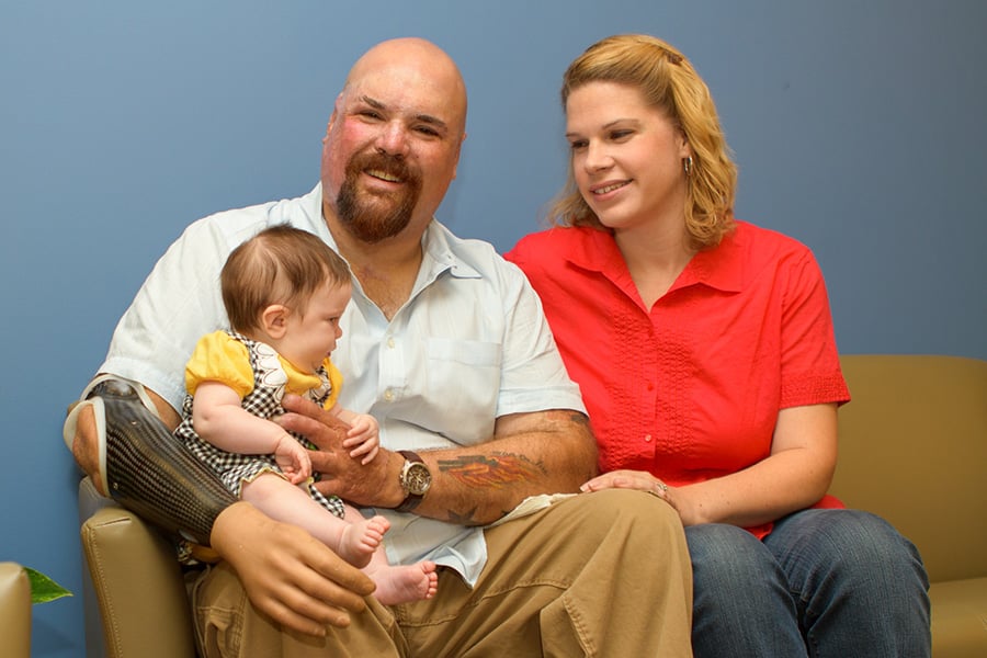 Parenting When You Have a Limb Difference – Babies