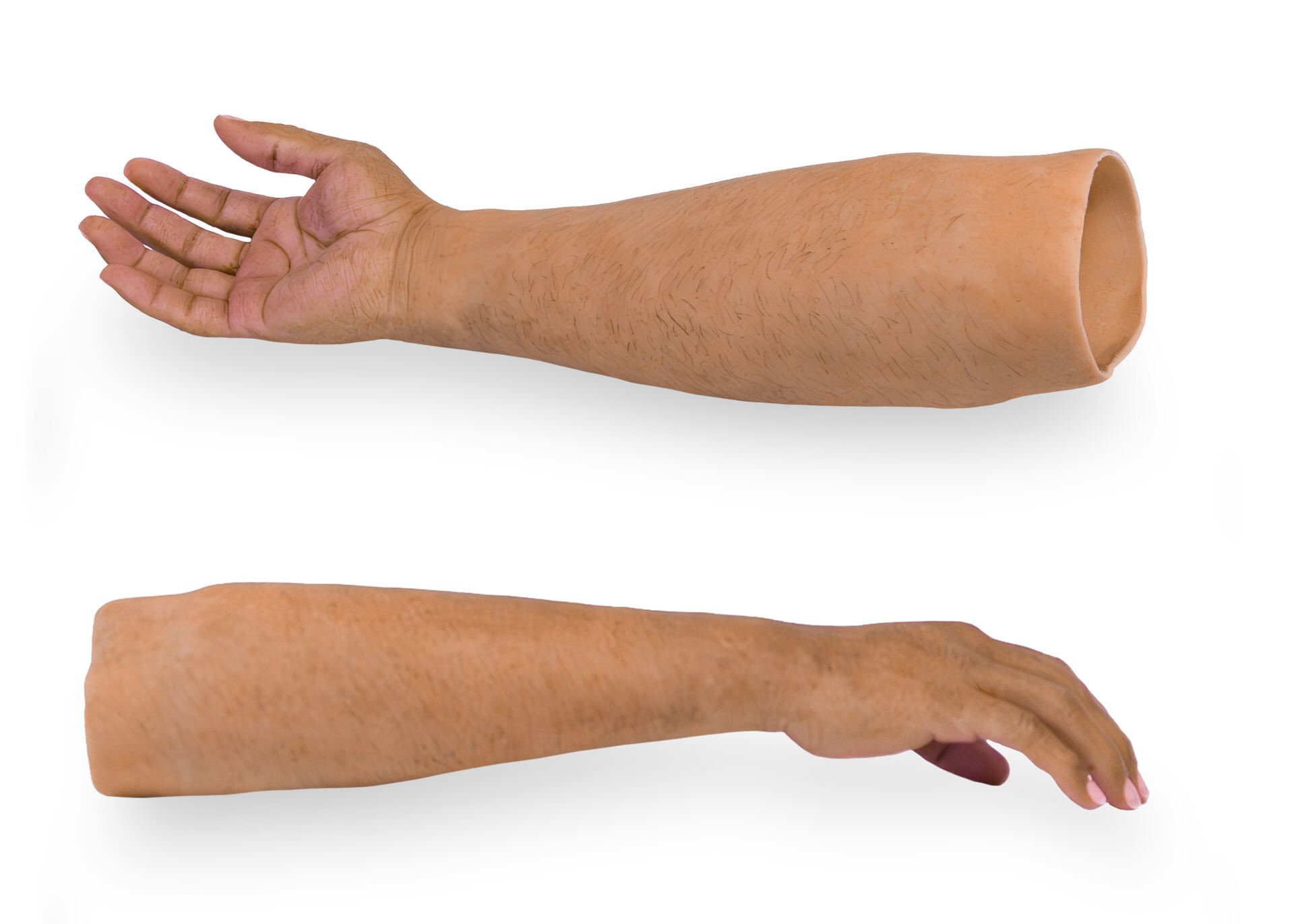Passive transradial cosmetic restoration