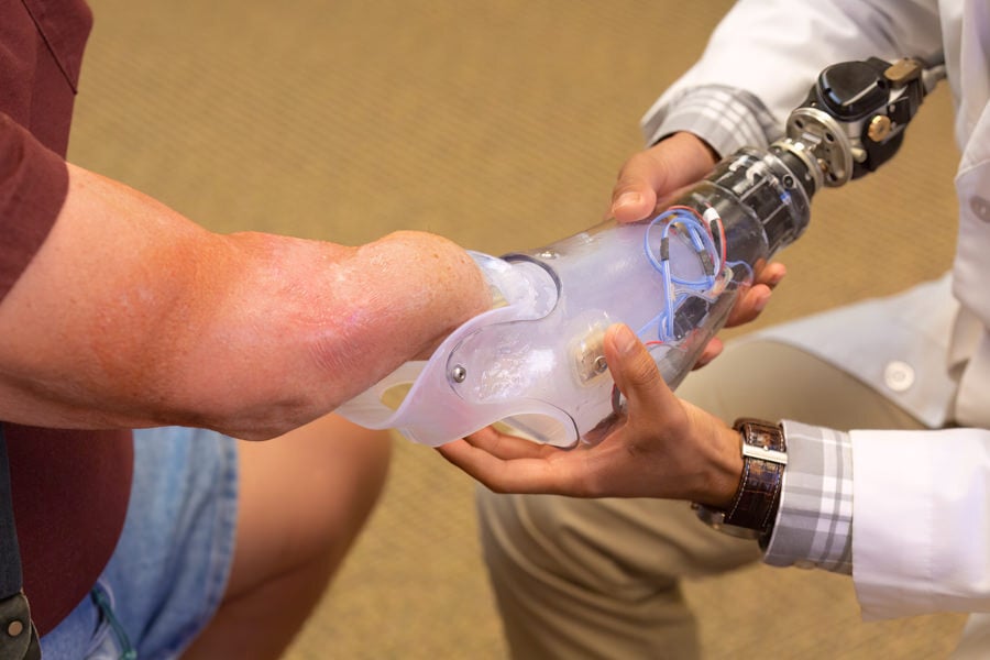 Patient being fit with initial prosthesis at Arm Dynamics