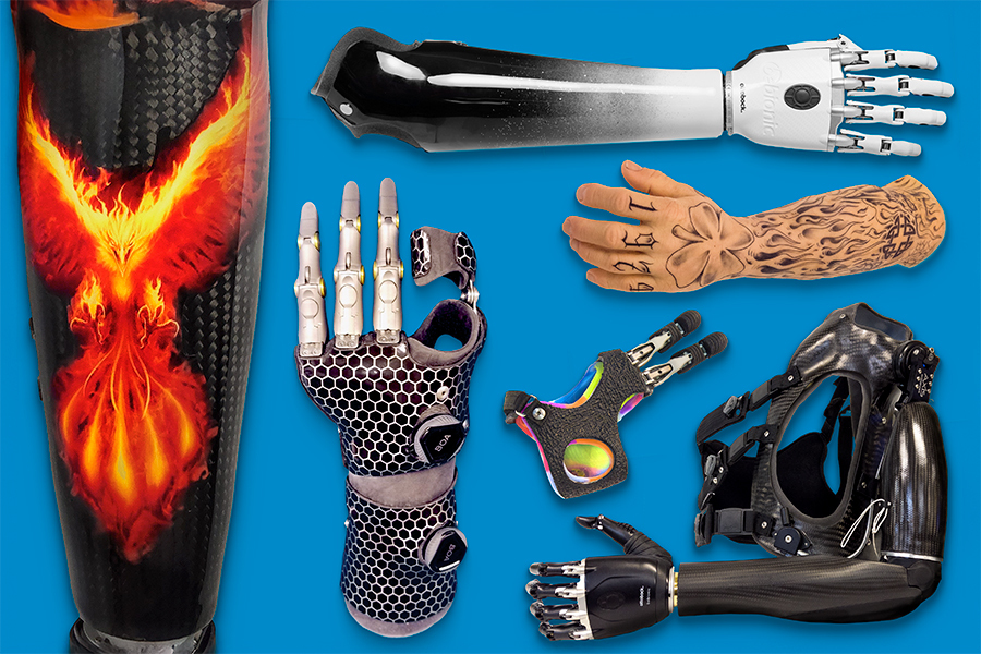 Prosthesis Showcase-Listing