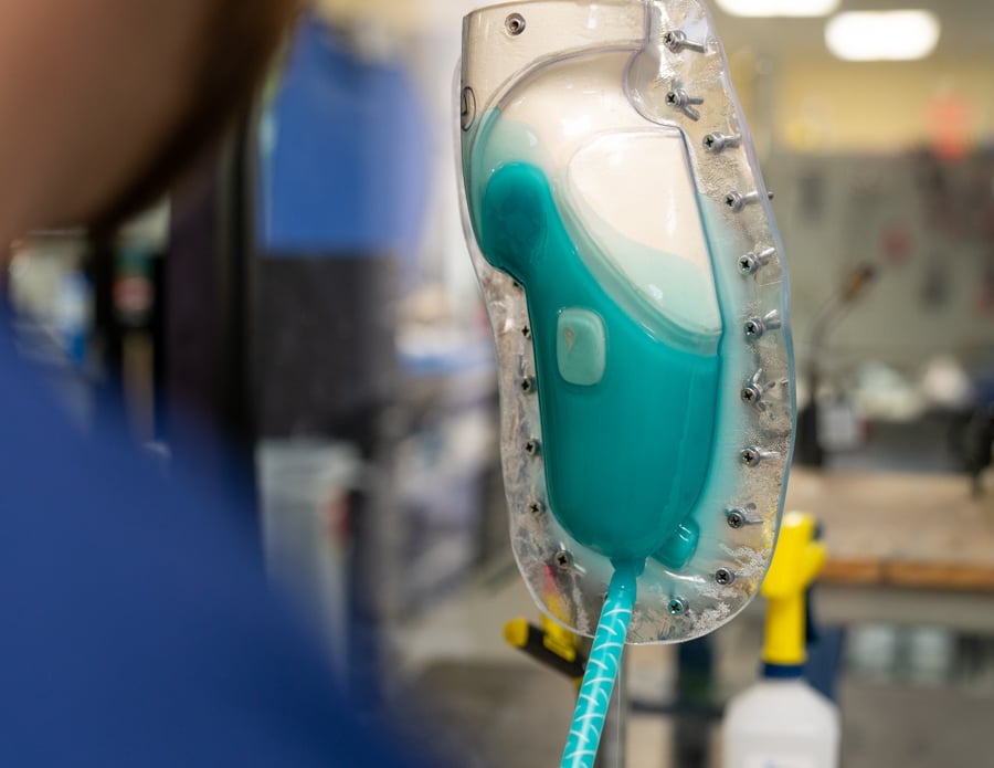 Custom Silicone Sockets The Ultimate in Comfort and Control for Prosthetic Arms