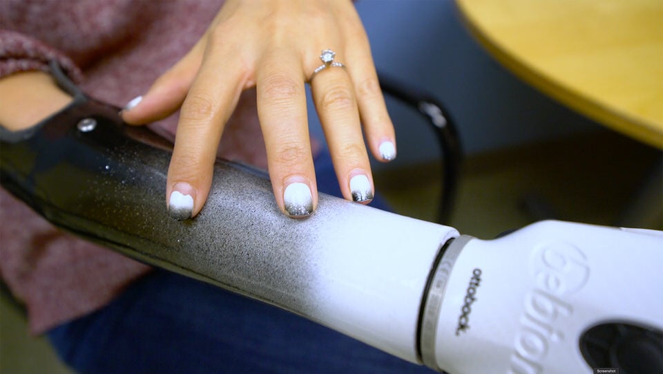 Shaholly Ayers custom socket and bebionic hand