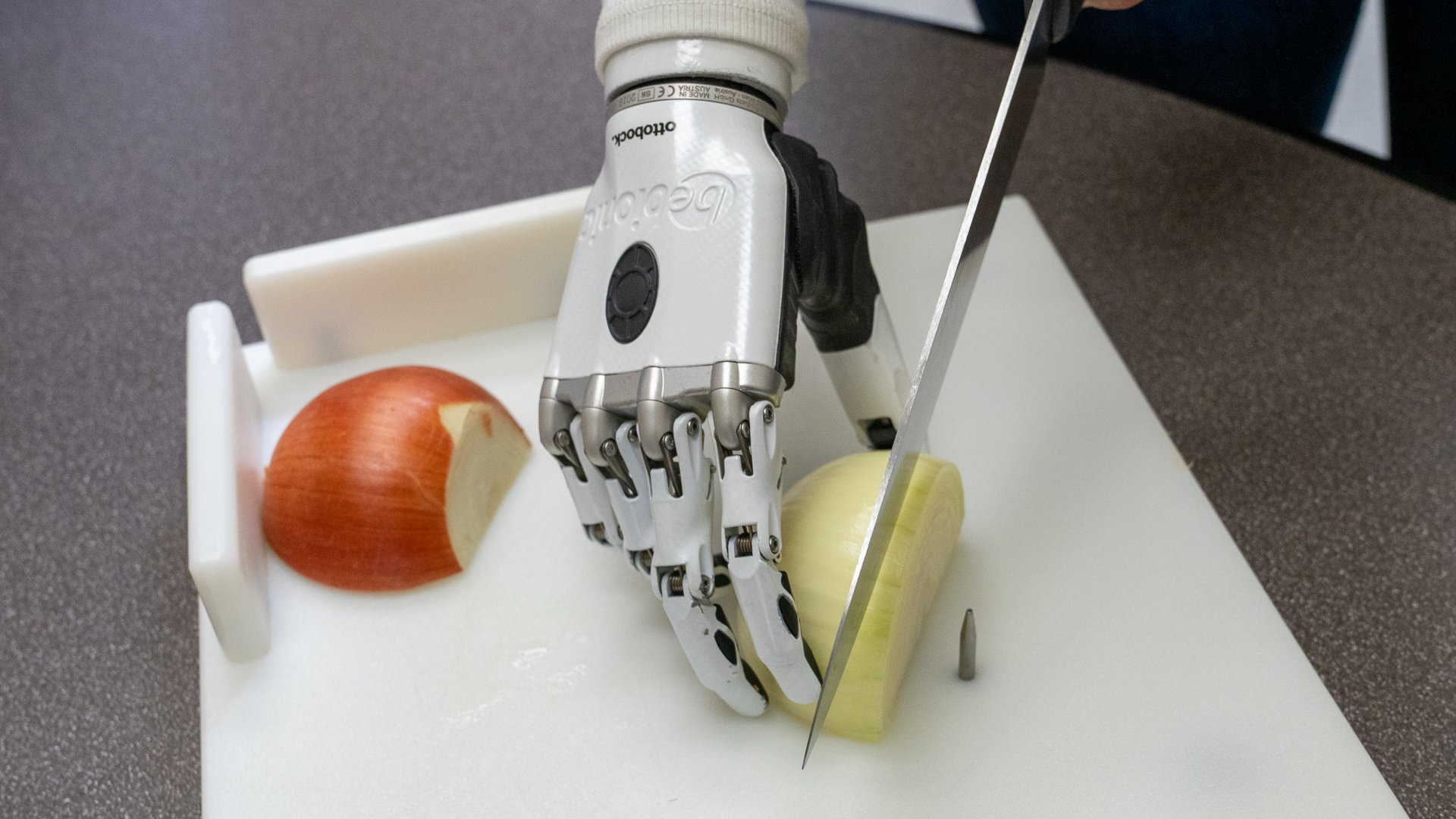 Shaholly Ayers bebionic hand