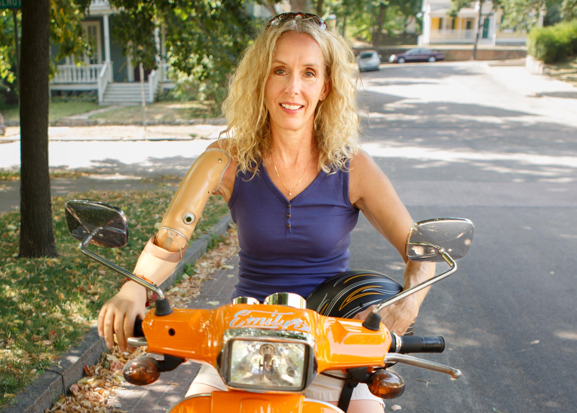 Sherri McCall on her scooter - Emily - with her transhumeral myoelectric prosthesis