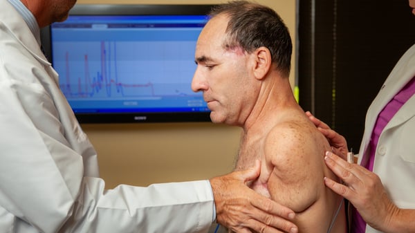 Shoulder Level (interscapular-thoracic) Amputee-2