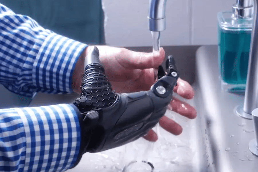The TASKA multi-articulating myoelectric hand, being washed with a sound hand at a kitchen sink.