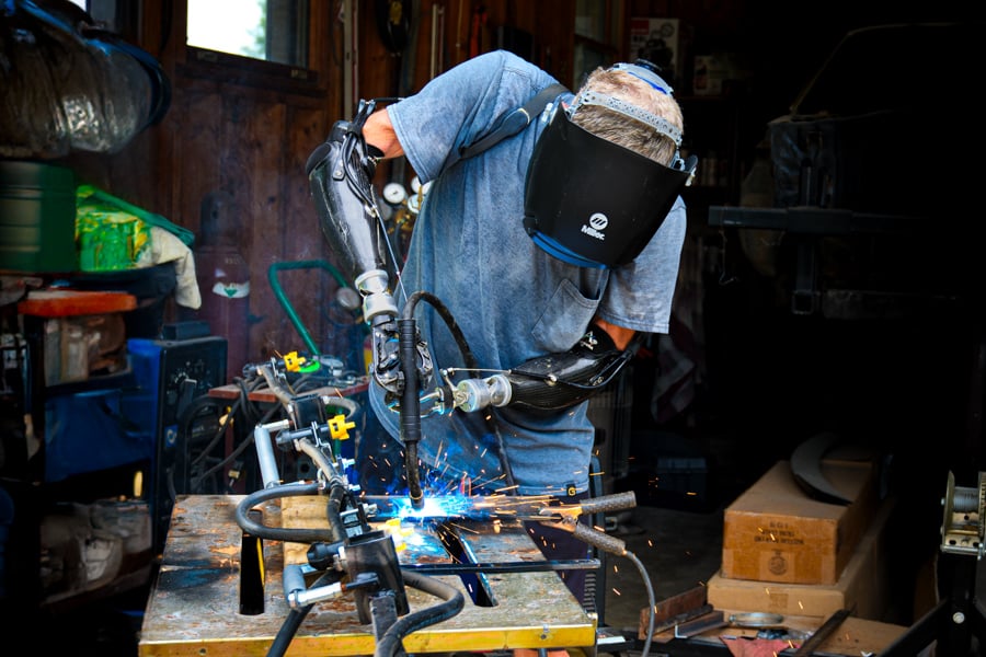 Upper Limb Amputee Welding