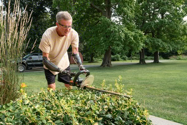 9. Supporting Limb Loss Patients and Caregivers