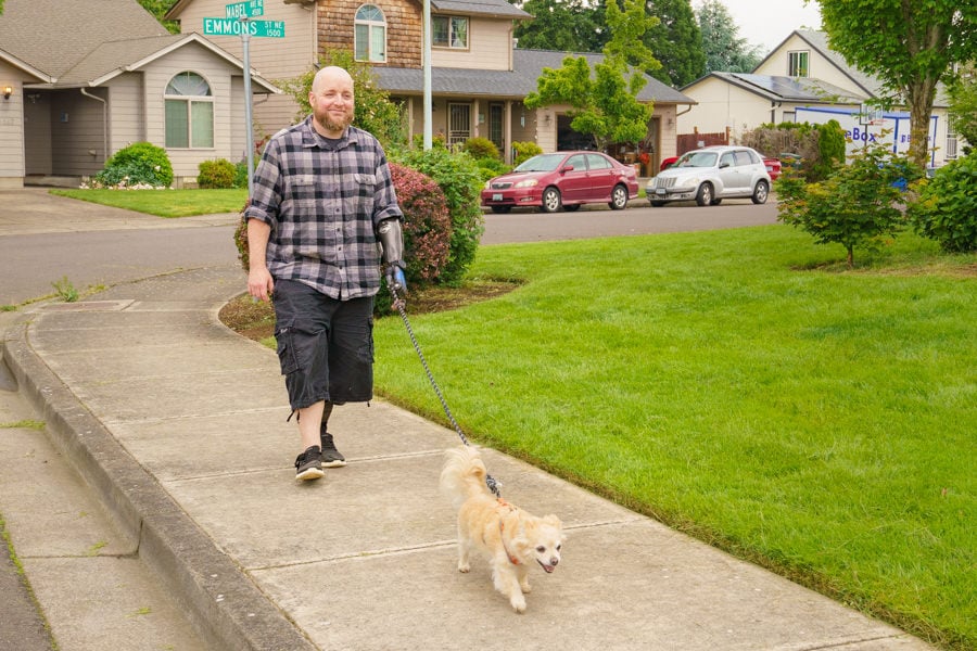 Upper limb amputee walking dog with taska hand