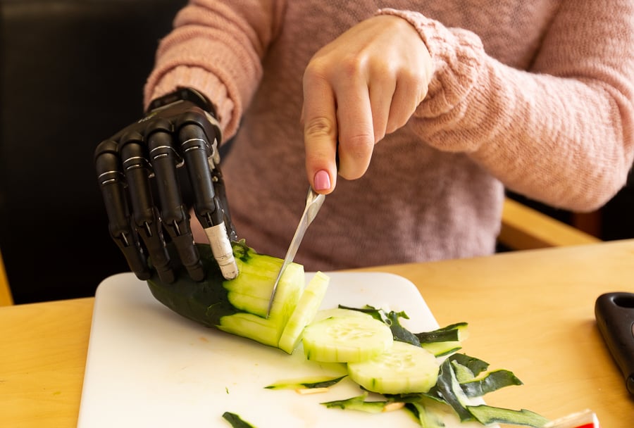 i-limb hand cutting vegetables