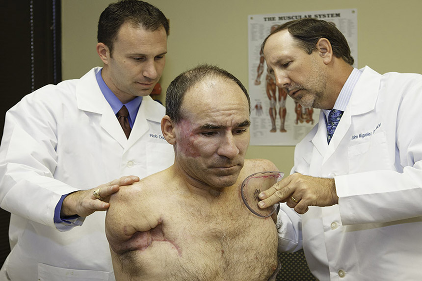Shoulder Level Patient with Upper Limb Prosthetists John Miguelez, CP, FAAOP(D) and Rob Dodson, CPO, FAAOP